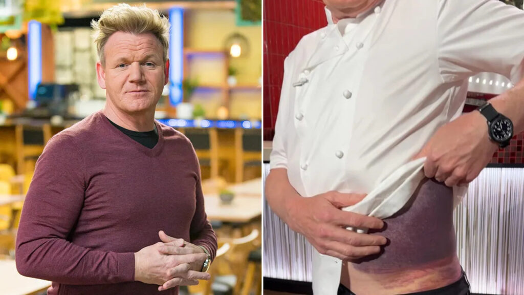 Gordon Ramsay Bike Accident